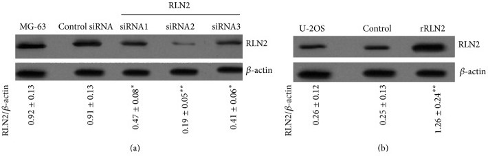 Expression of RLN2 in OS cells.jpg